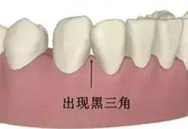 https://www.haodekuai.com/d/file/news/2e7u8o7uj2.jpg