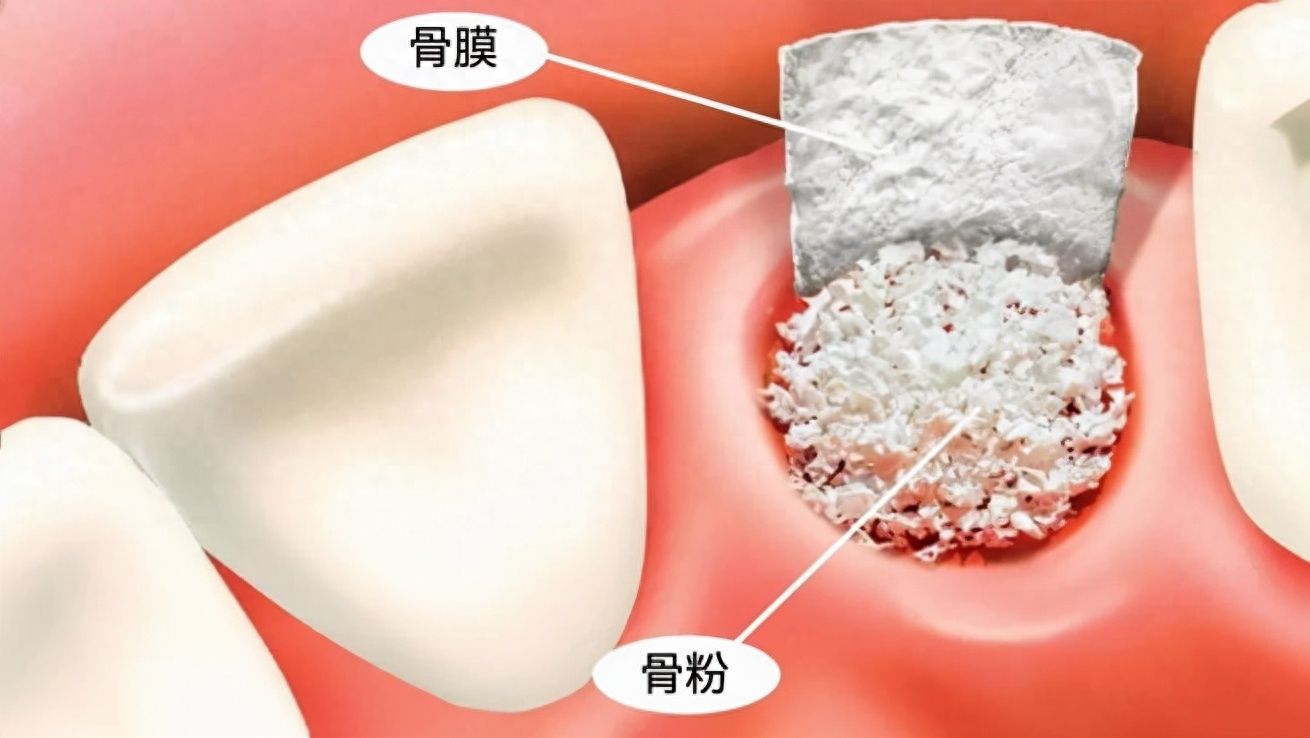https://www.haodekuai.com/d/file/news/2pce75yyhjvg.jpg