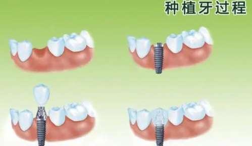 遵义华美口腔门诊部医保报销政策及收费标准
