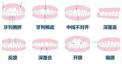 https://www.haodekuai.com/d/file/news/6razn8g43d.jpg