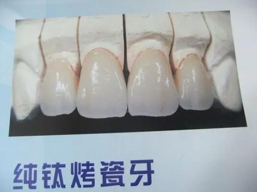 https://www.haodekuai.com/d/file/news/90e6vooerk.jpg