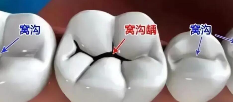 杭州富阳金铂利口腔门诊卓越技术赢得牙友推崇