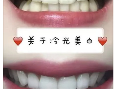 https://www.haodekuai.com/d/file/news/9p2d8k6cp6xn.jpg
