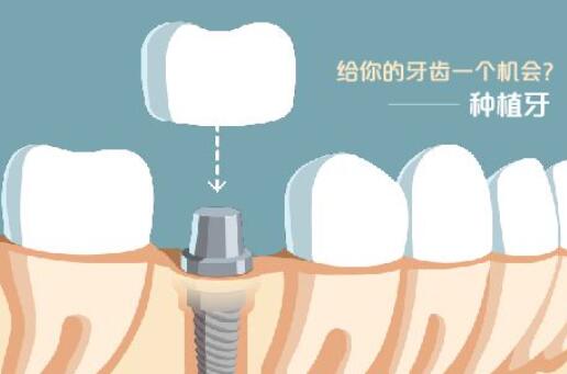 宁波江北牙科医院：口碑真实，患者称收费合理