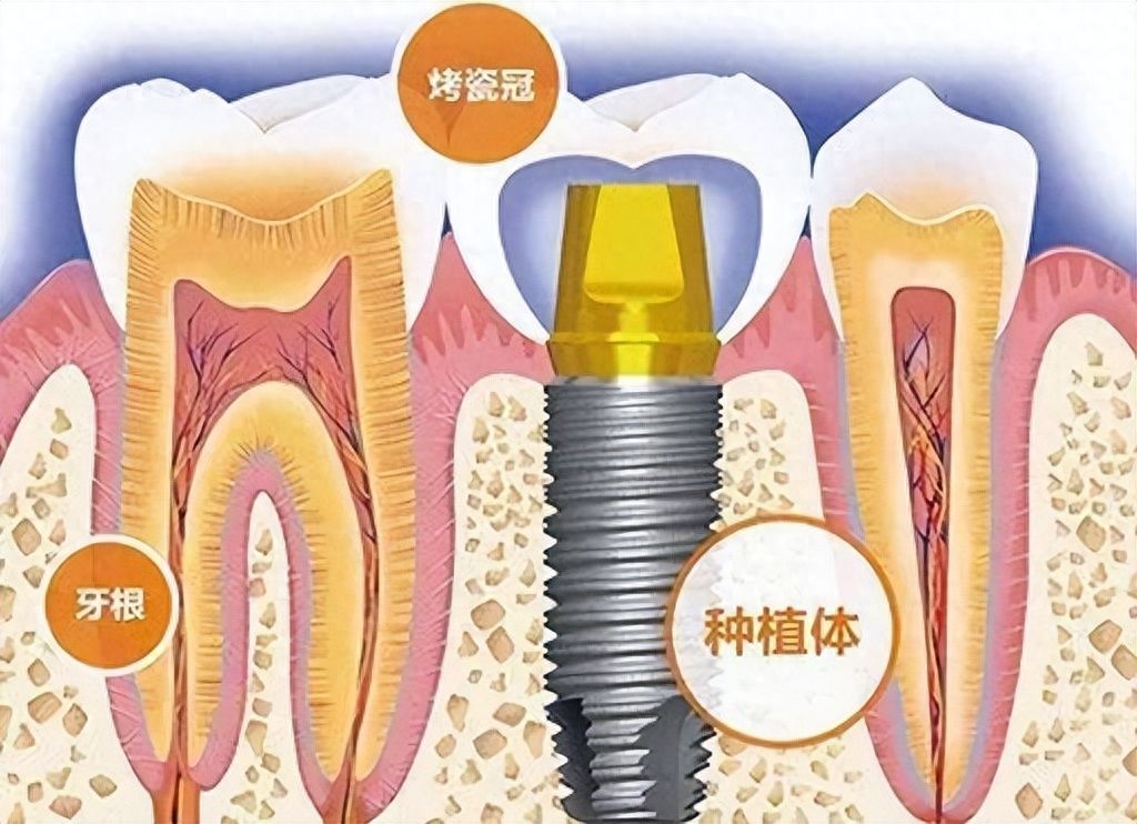 https://www.haodekuai.com/d/file/news/eg3h8b2ohacu.jpg