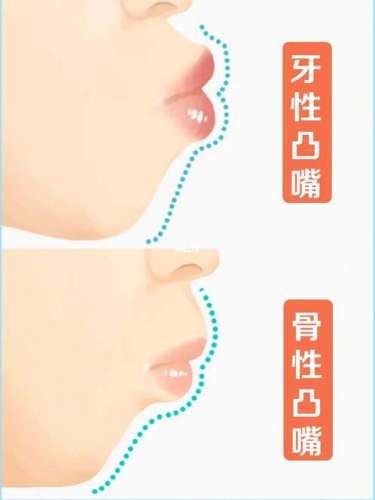 https://www.haodekuai.com/d/file/news/fwqj83r170ap.jpg