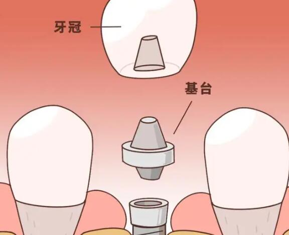 苏州中喜口腔，专业可靠 德技术先进 设备齐全 看牙就选它