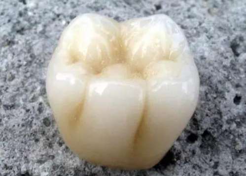 厦门思明区市峰煜口腔，让你的牙齿焕然一新！