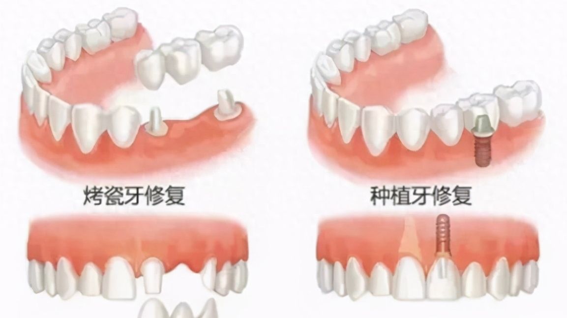 https://www.haodekuai.com/d/file/news/jl3hxm19ha.jpg
