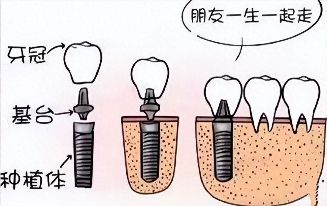https://www.haodekuai.com/d/file/news/ppaj39suyu1a.jpg