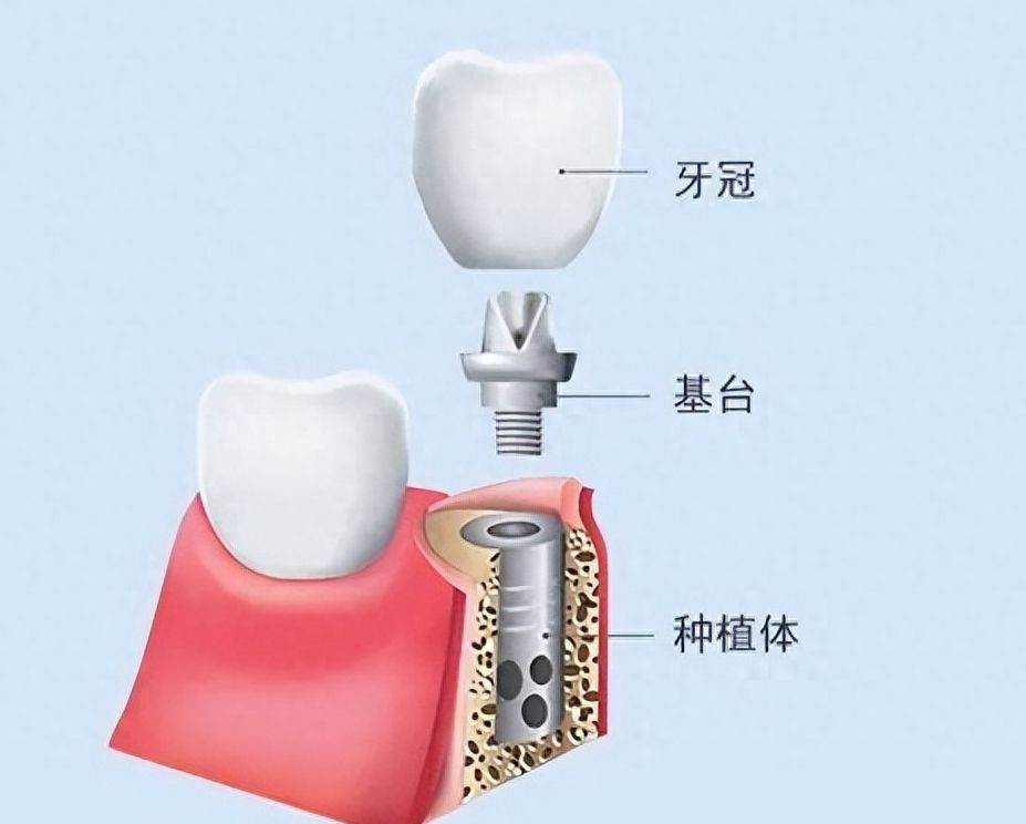 https://www.haodekuai.com/d/file/news/rdv6gzsqrhmf.jpg