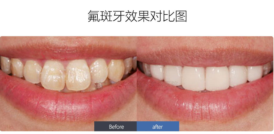 https://www.haodekuai.com/d/file/price/0924427817.jpg