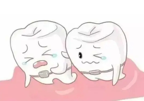 【许昌德菲口腔】矫正牙齿手术价格费用表公布！