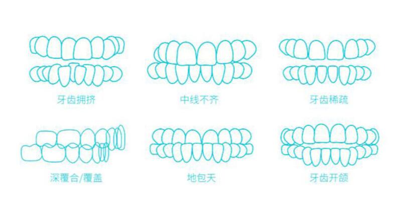 https://www.haodekuai.com/d/file/price/17lq5849de.jpg