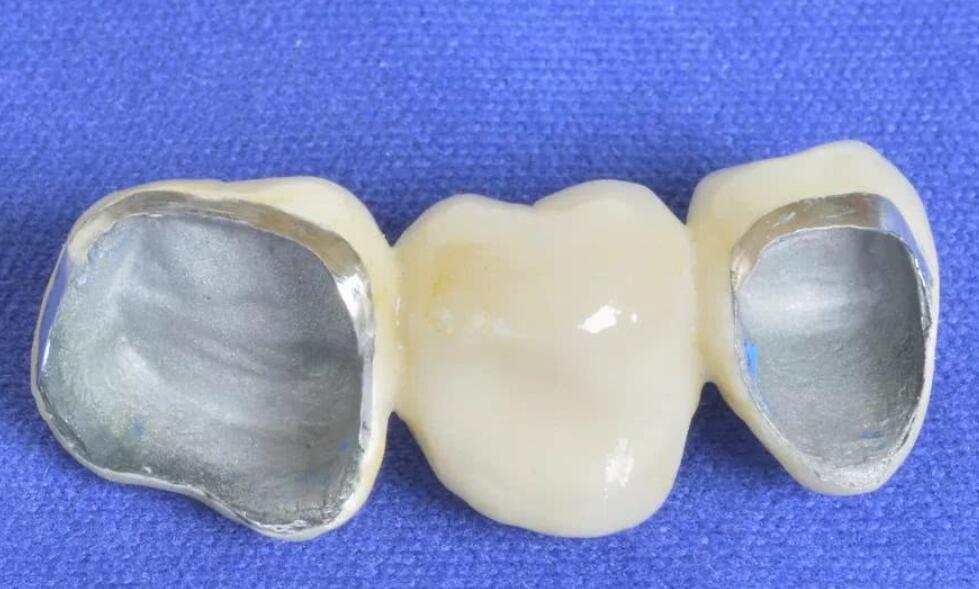 北京青苗口腔门诊部：拔牙矫正需要多少钱啊？
