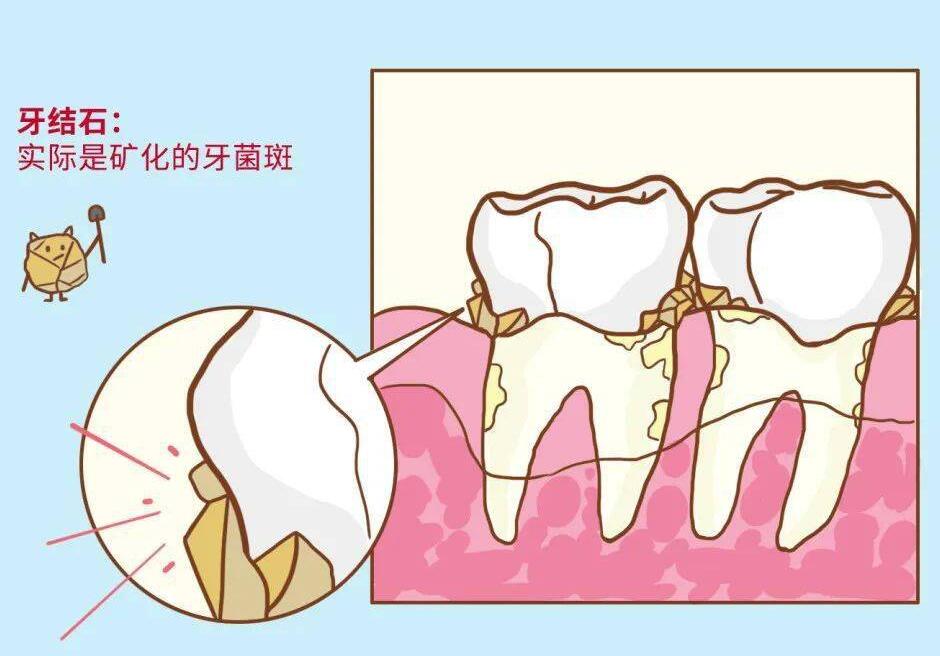 深圳微尔口腔：矫正牙齿隐形牙套的费用合理吗？