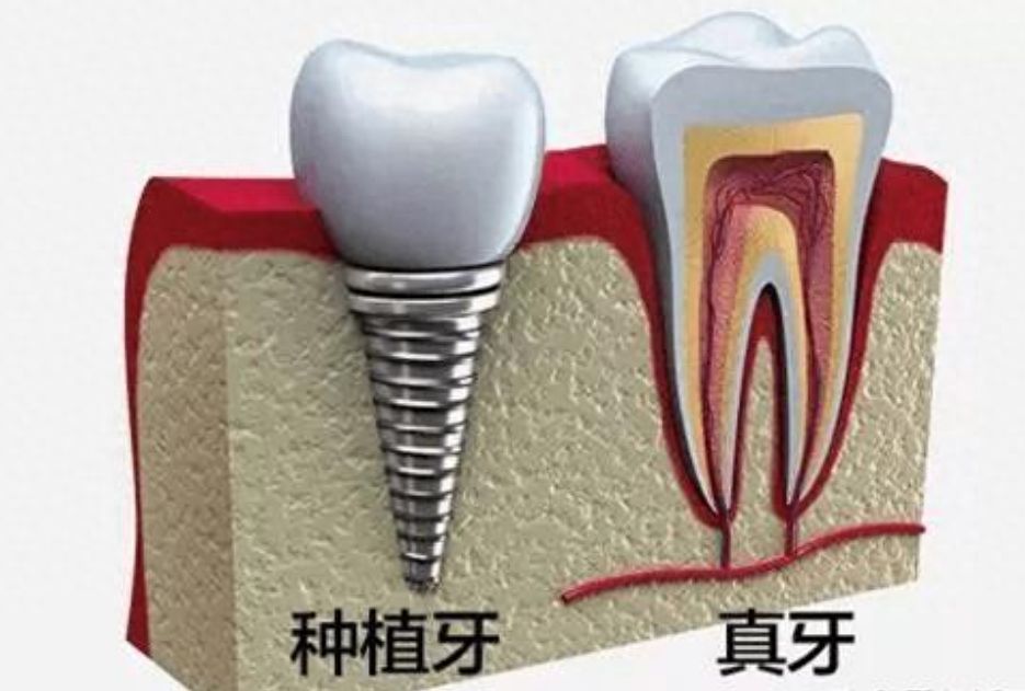 深圳启飞齿科价格公开与正规医院费用对比，看牙如何呢？
