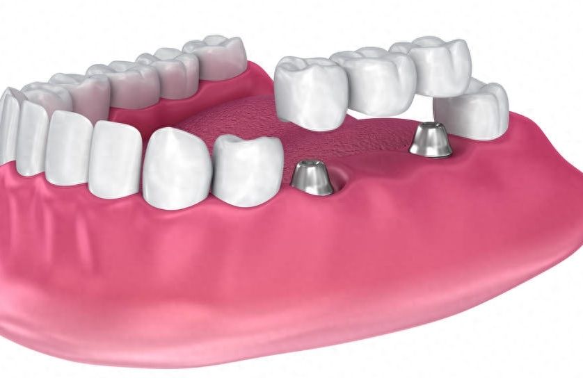 https://www.haodekuai.com/d/file/price/9xi65g0rgjmz.jpg