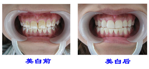https://www.haodekuai.com/d/file/price/BJW98I6N56.jpg