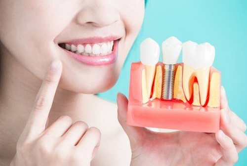 https://www.haodekuai.com/d/file/price/BKC717K92N.jpg
