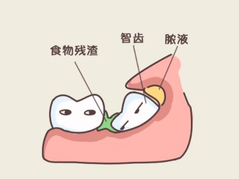 世纪坛医院口腔科：严重深覆合矫正的价格大概需要多少钱合理？