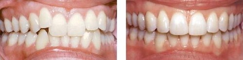 https://www.haodekuai.com/d/file/price/HF4XFDJQ87.jpg