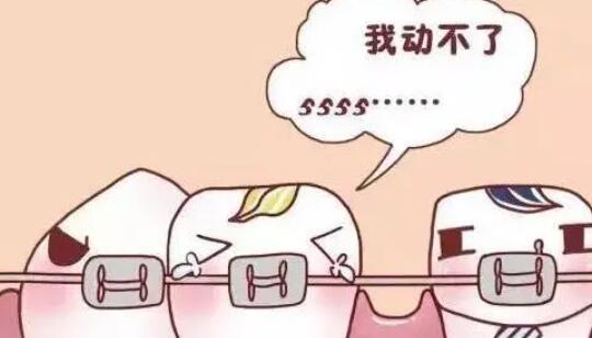 怀化第二人民医院口腔科提供国产陶瓷自锁托槽矫正手术，价格详细了解！