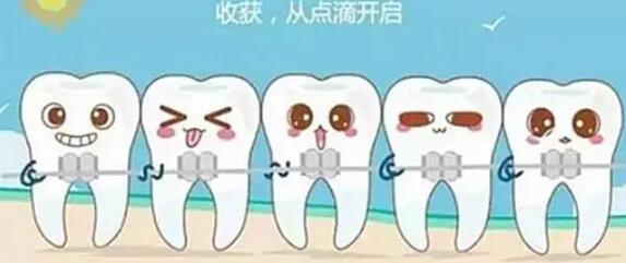 淮南第二人民医院口腔科：牙齿半隐形矫正，价格大揭秘！