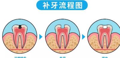 成都东区医院口腔科：国产博思美隐形矫正的费用一般需要多少钱啊？