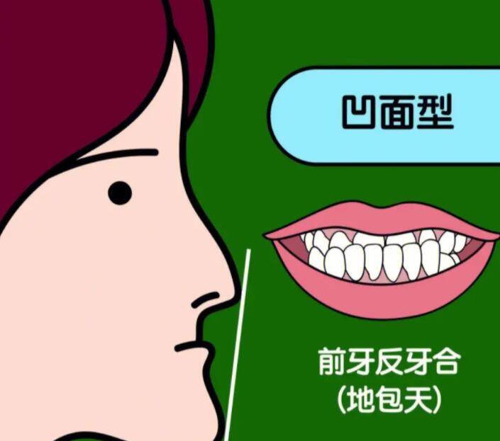新乡壹颗芽口腔矫正牙垫高多少钱一次做完？专业解答与实惠方案