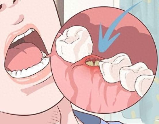 昆明美奥口腔医院牙齿种植效果如何？收费合理吗？