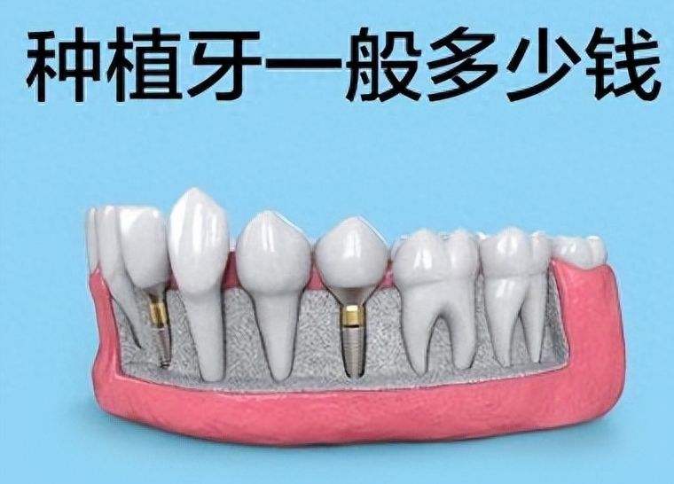 https://www.haodekuai.com/d/file/price/gtc2operei7m.jpg