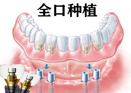 https://www.haodekuai.com/d/file/price/k3fs0purd87v.jpg