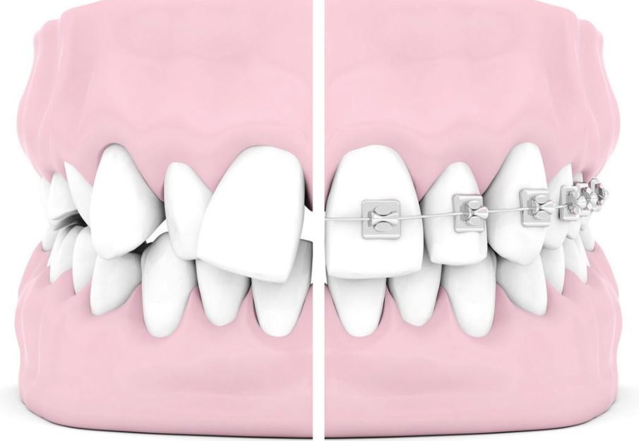 https://www.haodekuai.com/d/file/price/t1qzv44jgguh.jpg