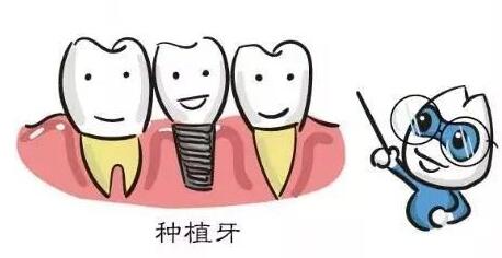 北京劲松口腔医院价格查询：种牙、正畸、根管治疗、补牙费用报价