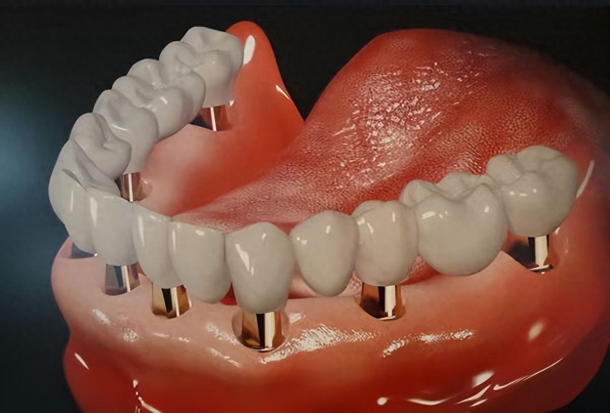 https://www.haodekuai.com/d/file/price/zsuwqf65xxh1.jpg