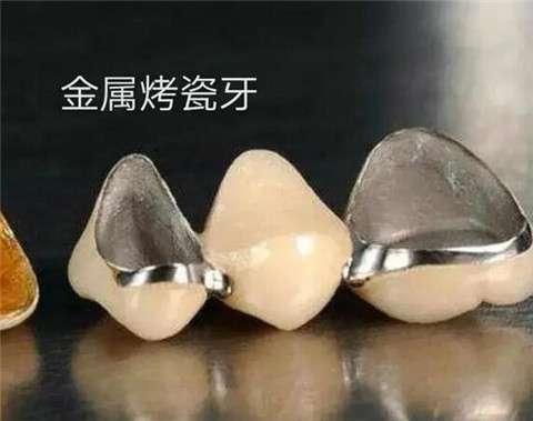 长海医院口腔种植科：徐晓刚、唐震专家团队介绍及价格表
