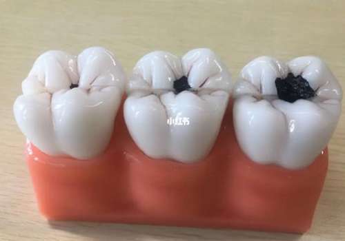 https://www.haodekuai.com/d/file/rank/mif6xyj9cfe4.jpg